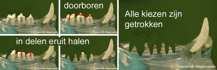 De onderkaaks kiezen worden in een vaste volgorde getrokken